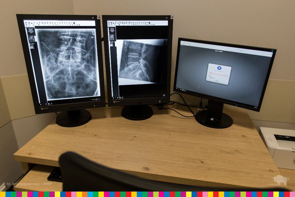 Monitors showing the x-ray image on the desk